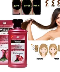 Wellice Onion Anti Hair loss Solution Shampoo