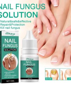 Anti Infection Nail Fungus Solution