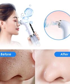 Super Micro Bubble Beauty Instrument Black Head Remover